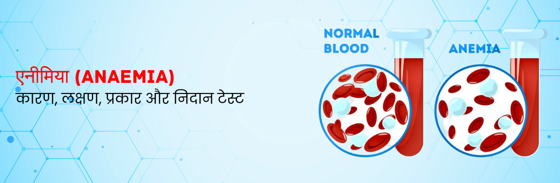 एनीमिया क्या है? इसके कारण, लक्षण, प्रकार और निदान टेस्ट